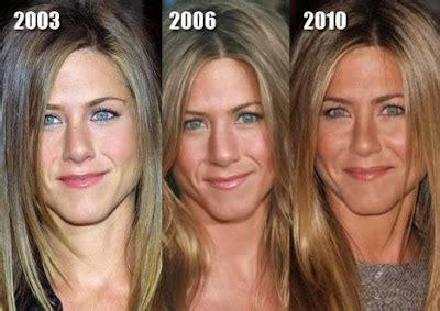 jennifer aniston breast job